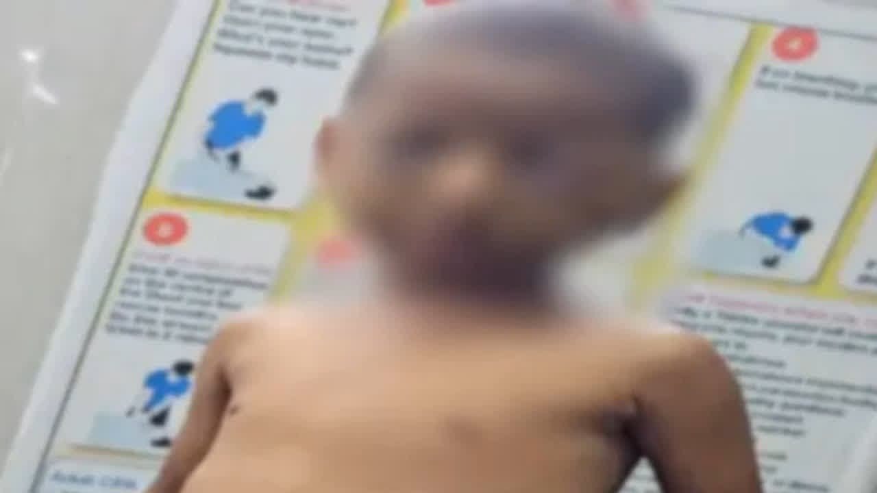 मासूम बेटे को सिगरेट से दागती थी सगी मां