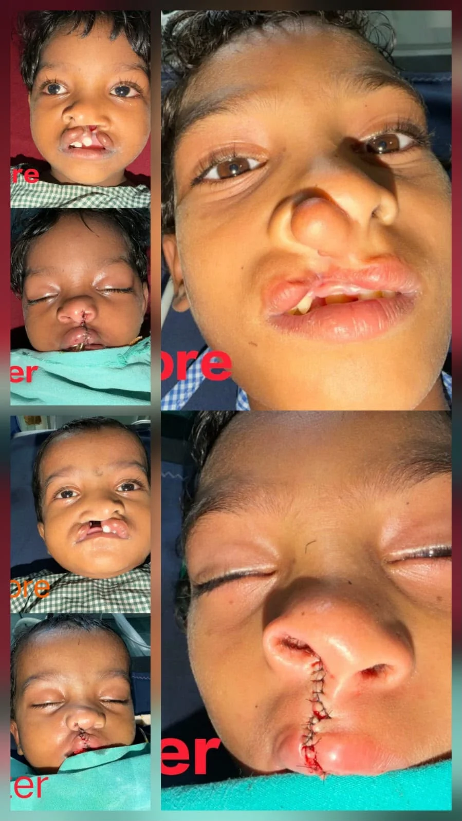चिरायु योजना से जन्मजात समस्या से मिली राहत, तीन बच्चों के चेहरों पर लौटी मुस्कान चिरायु योजना से जन्मजात समस्या से मिली राहत, तीन बच्चों के चेहरों पर लौटी मुस्कान